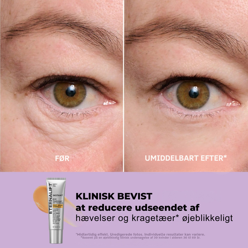EternaLift™ | Øjencremen der fjerner poser under øjnene øjeblikkeligt og får dig til at se 10 år yngre ud