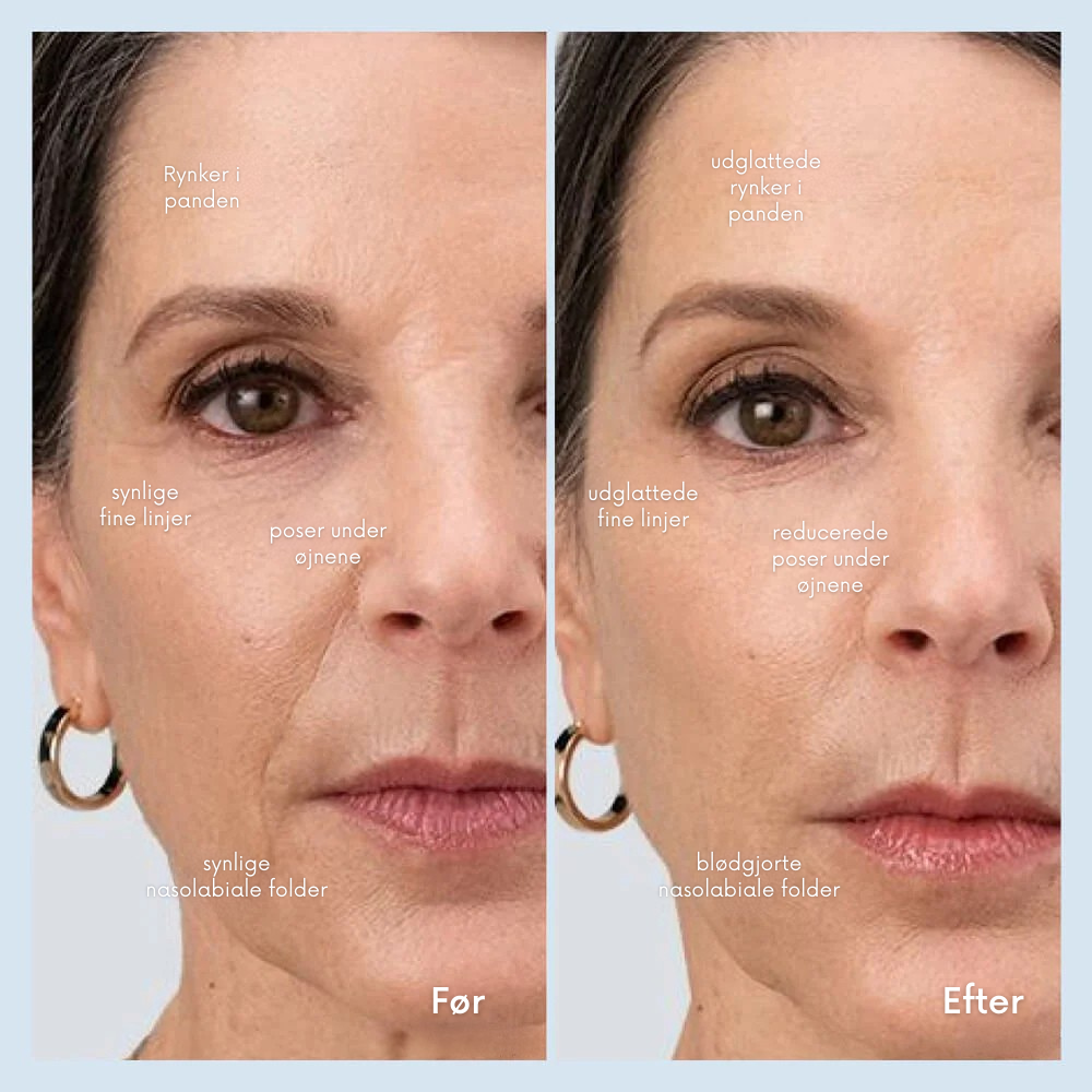FacialWand™ | Skab en fastere, glattere og mere strålende hud