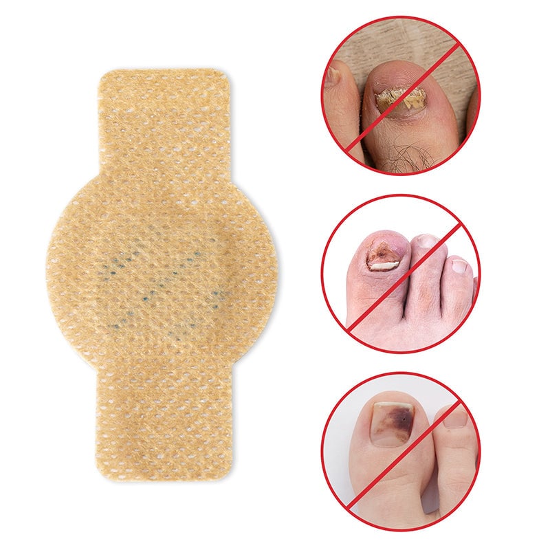 NailRepair™ | Plaster til neglesvamp
