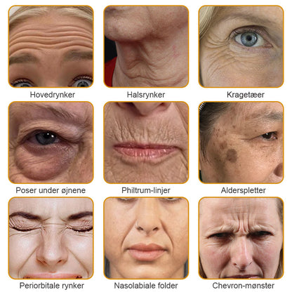 BeeYoung™ V3 Pro - Glat rynker, løft dit udseende – uden dyre behandlinger!