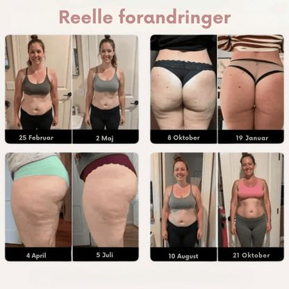 SculptWear™ | Sportsleggings der gør cellulite usynlig